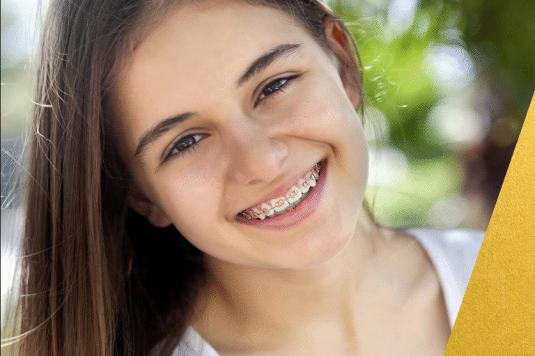 brackets precio